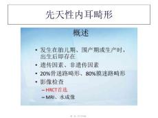 先天性内耳畸形