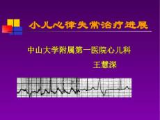 小儿心律失常治疗进展