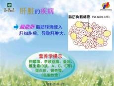 安利课件系列保肝护肝2酒精肝