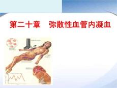 弥散性血管内凝血（PPT）