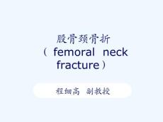 股骨颈骨折课件