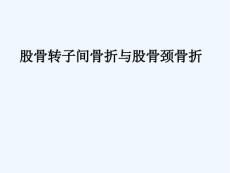 股骨转子间骨折与股骨颈骨折