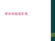 嗜铬细胞瘤影像