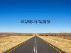 颈动脉海绵窦瘘