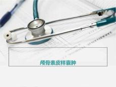 表皮样囊肿PPT课件