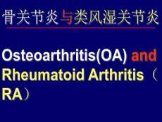 骨关节炎与类风湿关节炎ppt课件