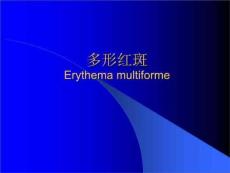 红斑及红斑鳞性皮肤病红斑