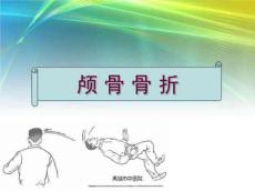 颅骨骨折的规范治疗