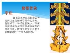 腰椎椎管狭窄症