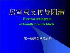《房室传导阻滞》PPT课件