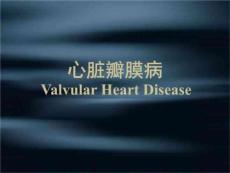 《心脏瓣膜疾病》PPT课件