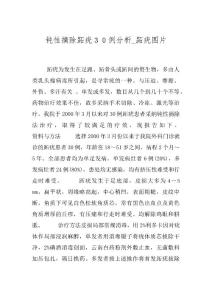 钝性摘除跖疣３０例分析_跖疣图片