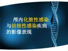 脑脓肿与脑结核影像表现