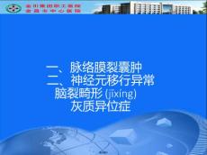 脉络膜裂囊肿
