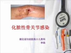 化脓性关节炎查房PPT课件