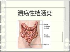 溃疡性结肠炎PPT