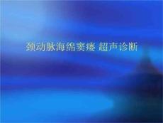颈动脉海绵窦瘘超声诊断