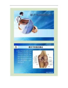 膝关节疼痛的诊疗