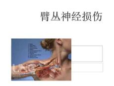 《臂丛神经损伤》PPT课件
