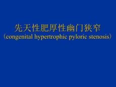 先天性肥厚性幽门狭窄