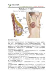 乳腺癌转移治疗