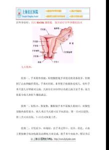 長(zhǎng)江HAXK腹腔鏡 保宮治療宮外孕微創(chuàng)技術(shù)