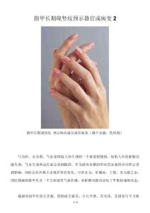 指甲长期现竖纹预示器官或病变2