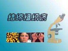 结缔组织病
