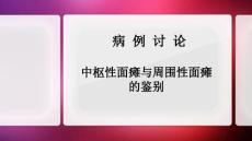 中枢性面瘫与周围性面瘫的区别