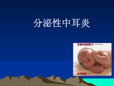 分泌性中耳炎 (4）