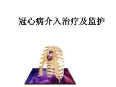 冠状动脉介入