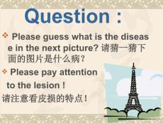 带状疱疹课件