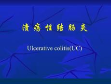 溃疡性结肠炎