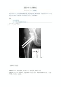 股骨颈骨折概述