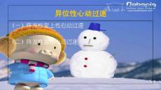 异位性心动过速