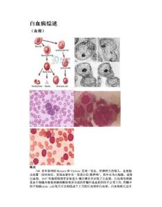 白血病综述
