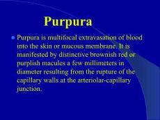 山西医大皮肤性病学课件-紫癜（Purpura）