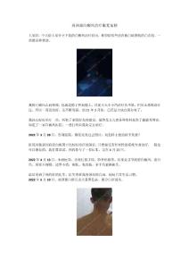 肩颈部白癜风