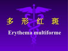 多形红斑Erythemamultiforme资料