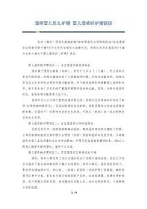 湿疹婴儿怎么护理 婴儿湿疹的护理误区