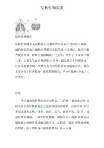 结核性胸膜炎
