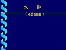 水肿edema概述一水肿的定义水肿过多的体液在