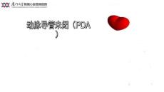 动脉导管未闭12633