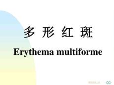 多形性红斑