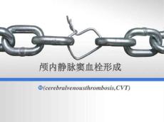 颅内静脉窦血栓形成医学PPT课件