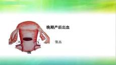 晚期产后出血3776