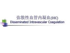 弥散性血管内凝血