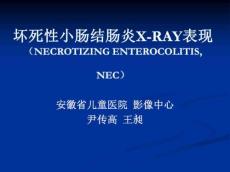 新生儿坏死性小肠结肠炎影像表现