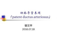 动脉导管未闭12626