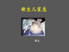 新生儿窒息